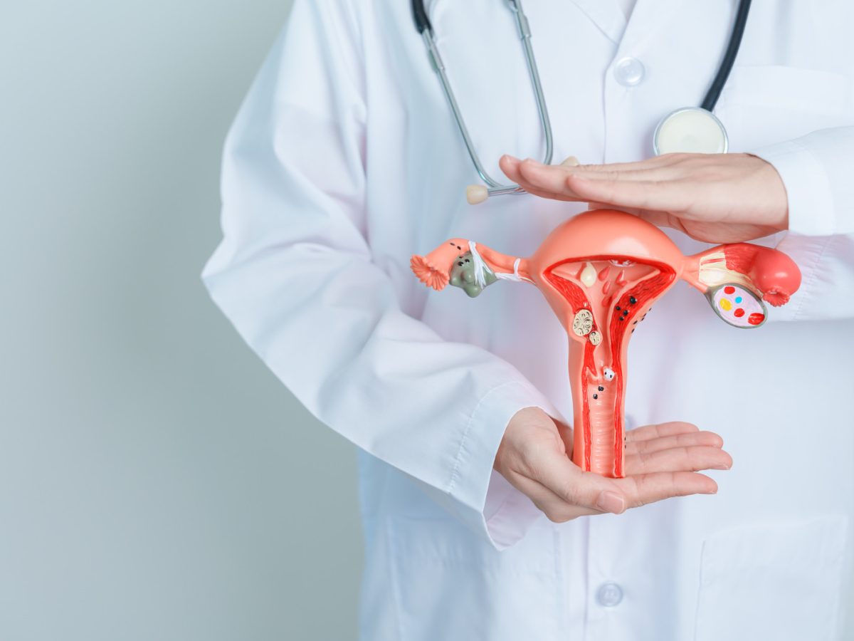 فیبروم رحم چیست؟