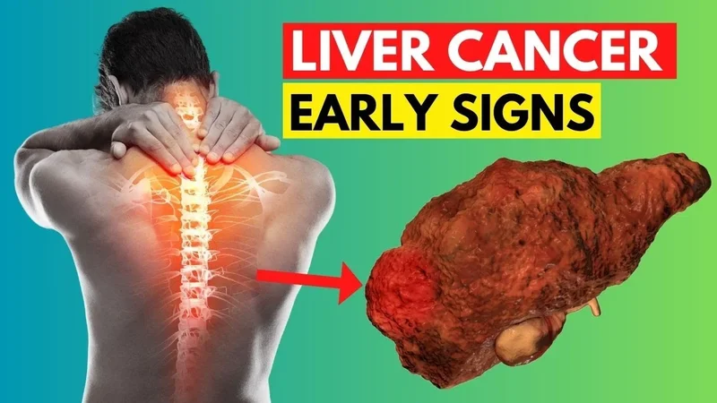 تومور کبدی: علائم، تشخیص، درمان و راههای پیشگیری برای حفظ سلامت کبد