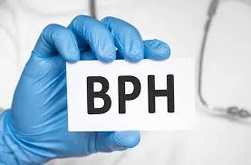 تفاوت سرطان پروستات با بزرگی خوش‌خیم پروستات (BPH) ؛ تشخیص درست، درمان مؤثر